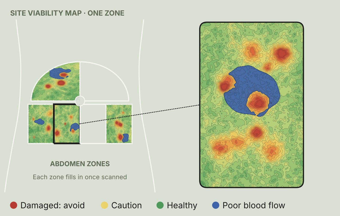 Illustrative site map in the Loci app